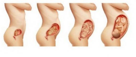 6 Aylık Gebelikte Karın Ağrısı Belirtileri ve Tedavisi